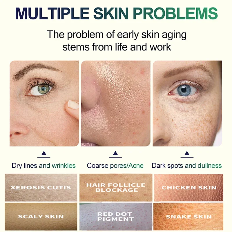 2ND Salicylic Acid Face Facial - đánh giá và giá Tranexamic Acid Serum