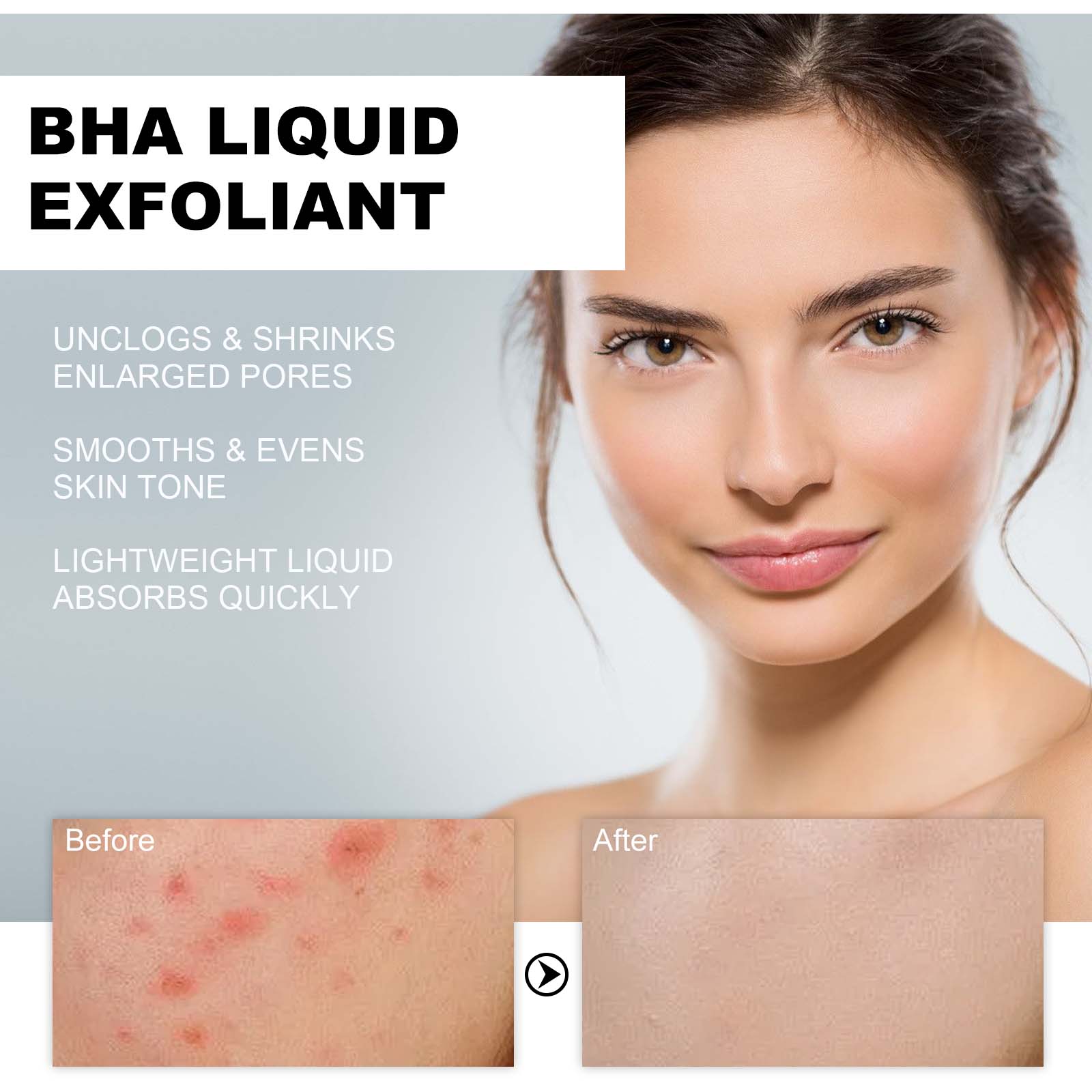 2% Salicylic Acid Liquid Exfol - đánh giá và giá Tranexamic Acid Serum