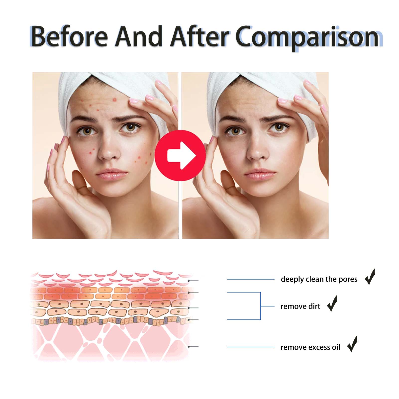 2% Salicylic Acid Liquid Exfol - đánh giá và giá Tranexamic Acid Serum