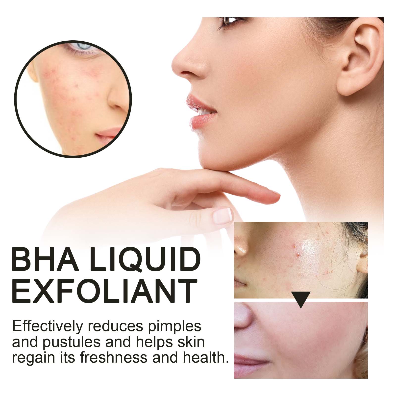 2% Salicylic Acid Liquid Exfol - đánh giá và giá Tranexamic Acid Serum