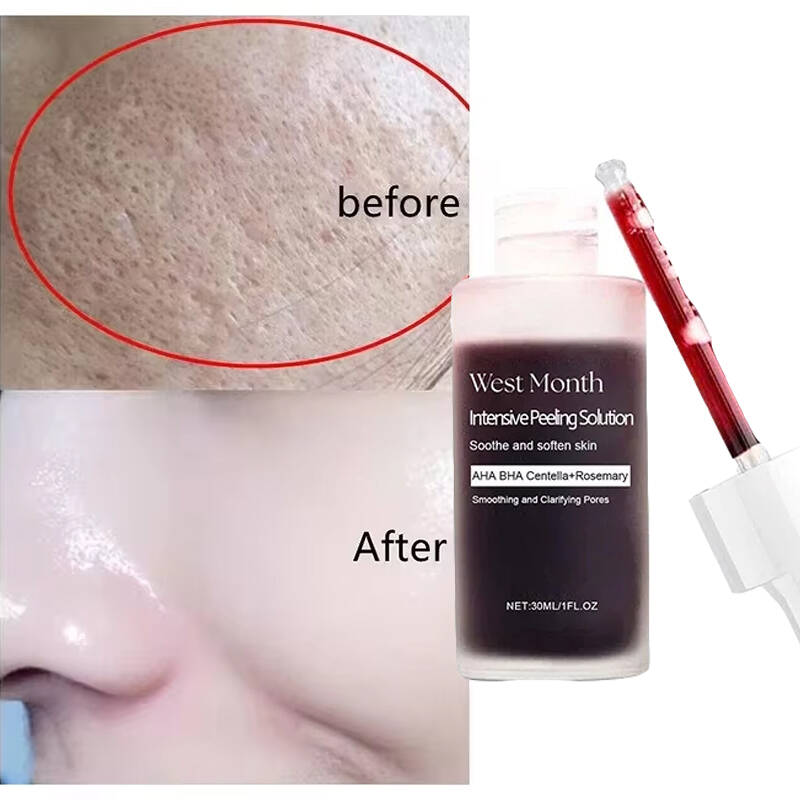 Feels Like Silk, Looks Like Fi - đánh giá và giá Tranexamic Acid Serum
