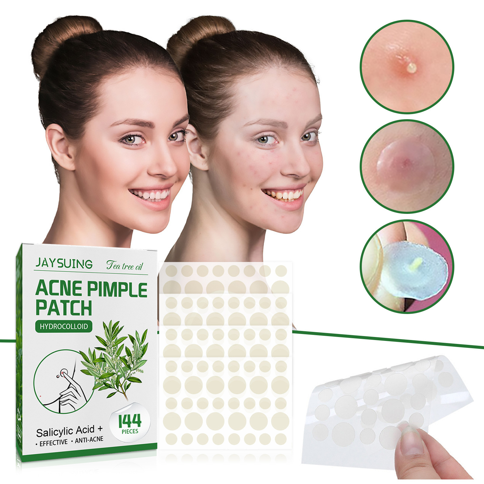 Hydrocolloid Acne Patches - Ab - đánh giá và giá Skincare The Originote