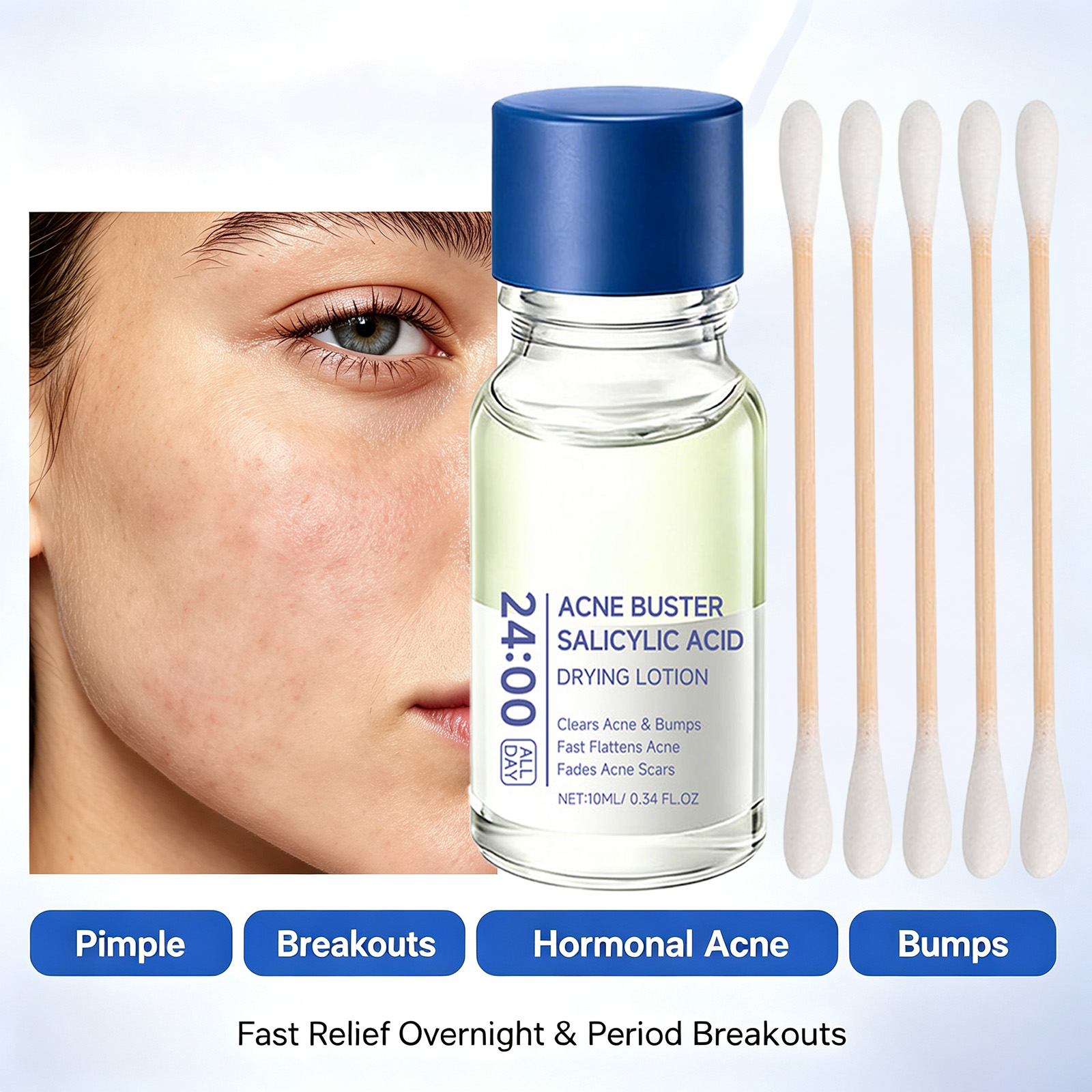 Salicylic Acid Acne Treatment  - đánh giá và giá Tranexamic Acid Serum