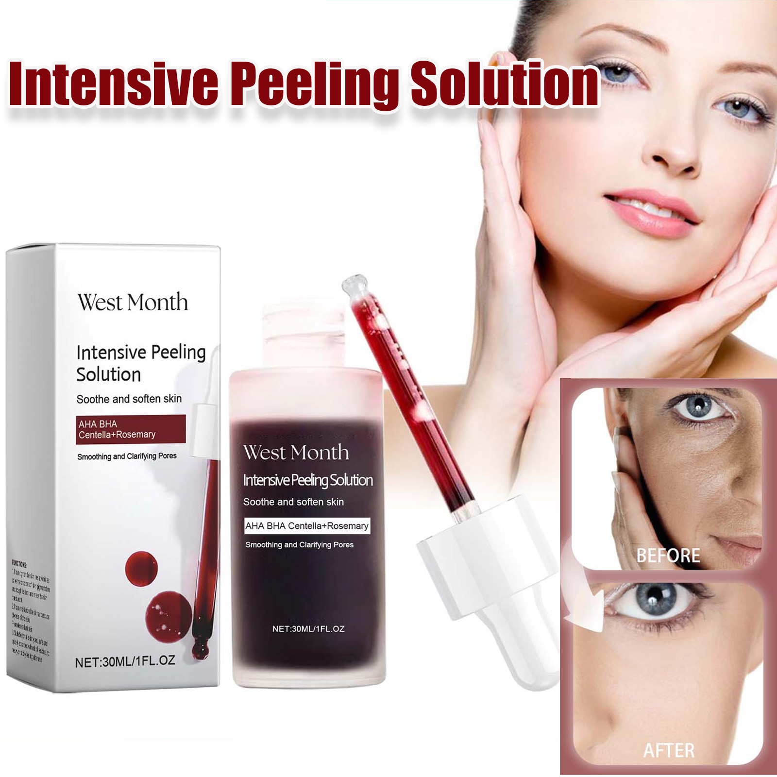 Peeling Face Serum Anti Acne B - đánh giá và giá Tranexamic Acid Serum