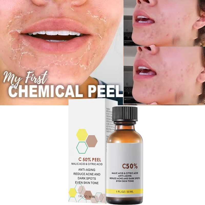 With Malic Acid And Citric Aci - đánh giá và giá Tranexamic Acid Serum